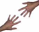 Hands of the 12th World AIDS Conference